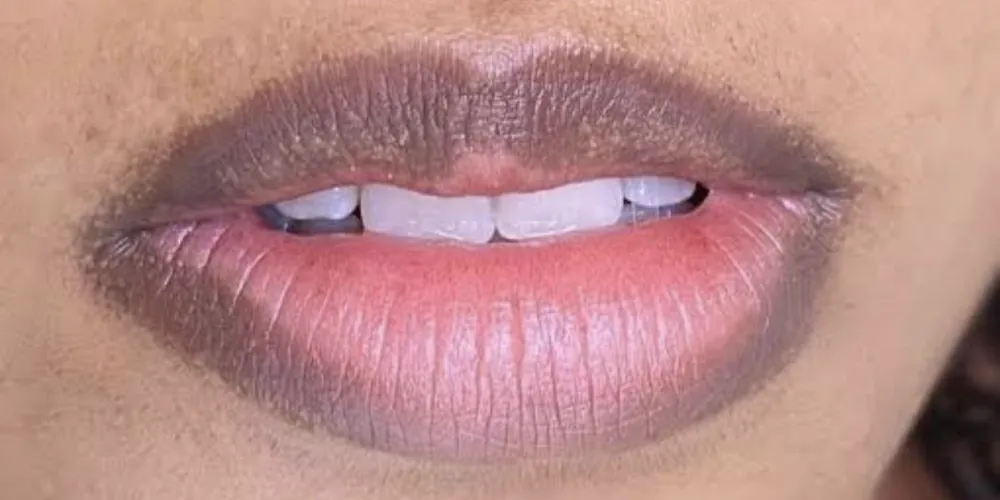 Antes da neutralização labial: lábios com o contorno bem mais escuro que o centro
