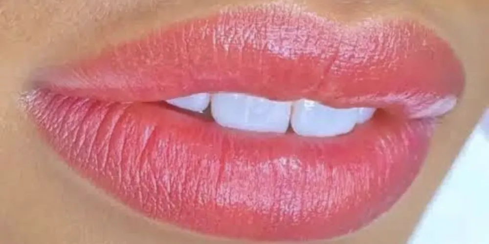 Depois da neutralização labial: lábios com cor viva e uniforme