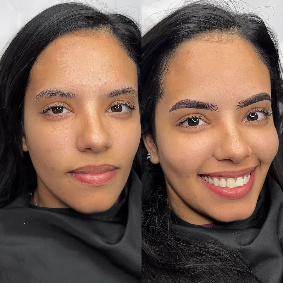 Antes e depois lado a lado: à esquerda sem a técnica, à direita com Shadow Line
